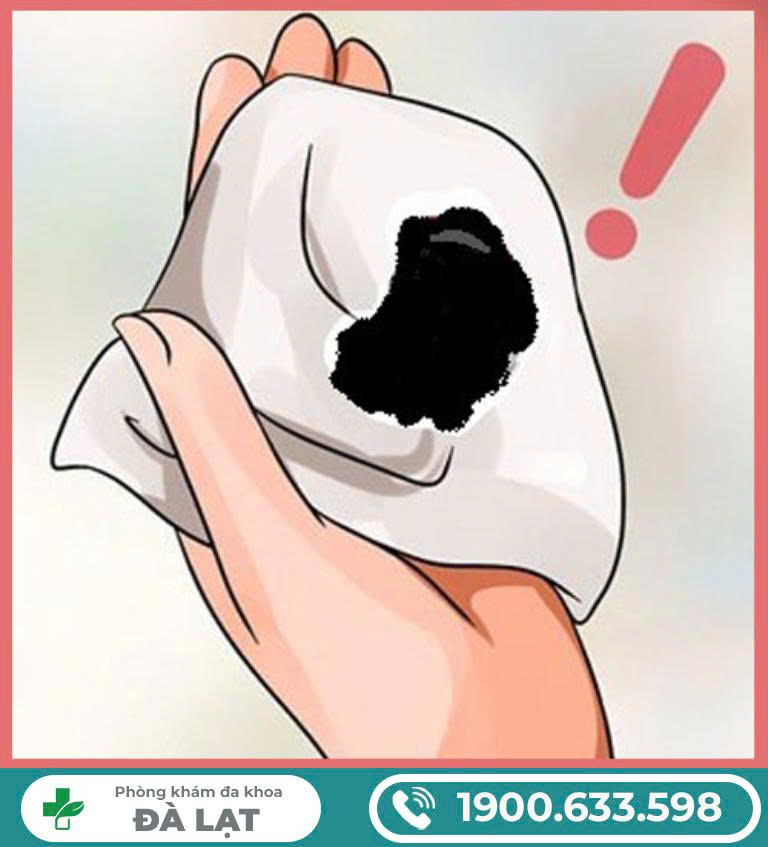 Hình ảnh minh họa